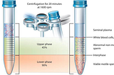 Sperm Selection: A Key to Fertility