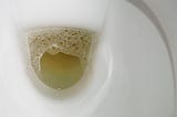 What Causes Foamy Urine? Causes of Foamy Urine