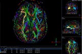 Problems and Challenges for a Science of Consciousness