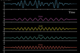 How FTT catches specific signal from voice data?