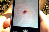 A Novel App To Help People Detect Early Skin Cancer Just Launched Today