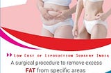 Liposuction In India