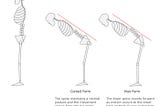 Disc Herniation Series (Part 2)
