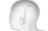 Neuralink — A link between man and machine: