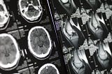 Generating MRI images of Multi-Contrast