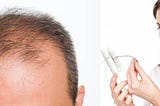 How to treat Hair loss and Baldness