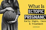 What is Ectopic Pregnancy: 5 Alarming Early Signs, Causes And Treatment