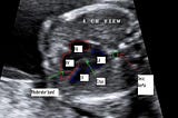 Three Lifesaving Ultrasound Exams During Pregnancy