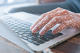 digital hands on a computer keyboard