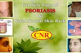 Herbal Treatment For Psoriasis| CNR HERBS