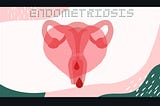 Endometriosis