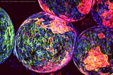 Exploring Beta Cell Regeneration in Treating Type 1 Diabetes