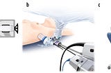 Intuitive Surgical and Mayo Clinic’s Brazen FDA End-Run: Clearance to Sell Robotic Mastectomy While…