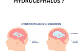 DUSHYANT VERMA — WHAT IS HYDROCEPHALUS ?