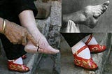 The most painful tradition done in the name of beauty- “Foot binding”