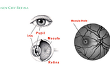 Embracing Macular Hole Surgery: A Vital Step for Vision Health