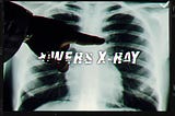 POWER’S X-RAY