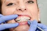 Why Orthodontic Care in Tallahassee is Worth the Expense