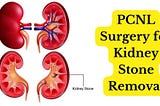 What is the role of diet in preventing kidney stones?