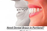 Braces Quotes Portland — Your Answer Here