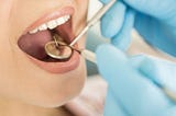 What are the procedures and the benefits related to dental implants Malvern?