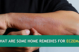 What are Some Home Remedies for Eczema?