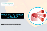 What are the causes of Stroke?