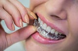 Invisalign: A Comprehensive Guide
