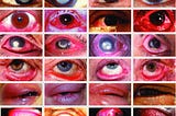 “AI Proves Your Eyes Are The Window to Uncover Your Diseases”.
