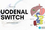 What is duodenal switch surgery with procedure diagram