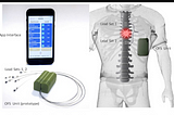 Short post on why high tech implants cost so much — from a technical perspective