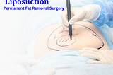 Liposuction in Kolkata: Permanent Fat Removal Surgery