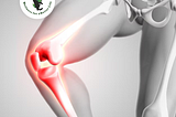 Elderly Knee Pain: An Ayurvedic Approach Using RiDVi Ortho Well Oil and Tablets