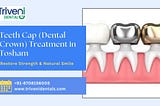 Teeth Cap (Dental Crown) Treatment in Tosham