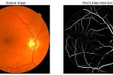 PhyCV - The First Physics inspired Computer Vision Python library