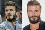 Beard it like Beckham — David Beckham has Facial Hair Transplant