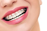 Orthodontic Treatments — Much more than just a smile