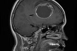 Revolutionizing Radiology: Integrating Machine Learning Models for Enhanced Brain Tumor Diagnosis