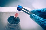 Stem cell therapy is changing medicine (part 2)