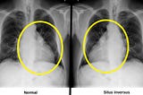 Data Augmentation in Medical Images