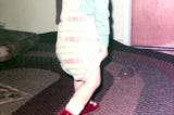 Me at age one walking in orthopedic shoes.