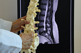 Should You Get an MRI for Low Back Pain?