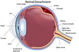 Dr. Rohit Varma an expert Ophthalmologist