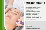 Microneedling in Houston, TX: Achieve Radiant Skin at Clariti Medspa