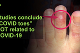 Studies conclude “COVID toes” are not related to COVID-19