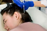 Follicular Unit Extraction — An Effective Hair Restoration Technique