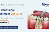 Failed Root Canal? How Re RCT Can Help Save Your Natural Tooth