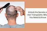 Unlock the Secrets of Hair Transplants: What You Need to Know