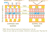 Healthy vs Damaged Skin Barrier