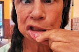 Woman author poses at a restaurant table, cross-eyed, and holding open her bottom lip that she just bit down to exposed, bloody flesh